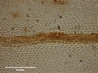 Abietinella abietina (Hedw.) Fleisch. Collection Image, Figure 9, Total 9 Figures